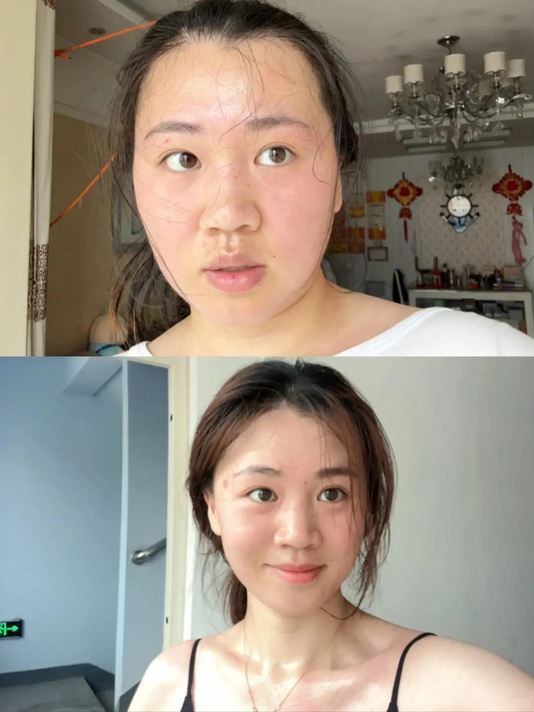 胰岛素抵抗减肥瘦了的变化