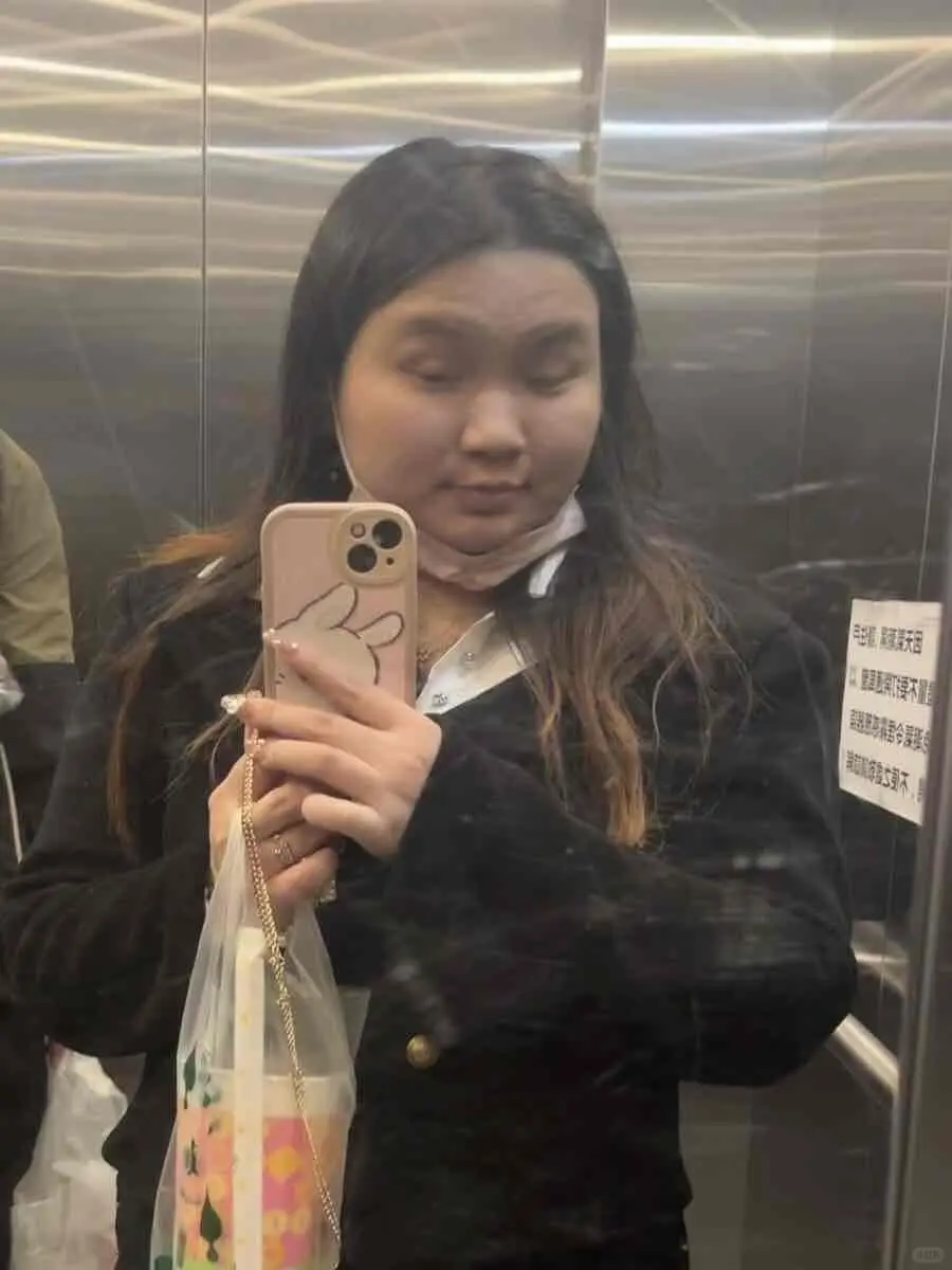 胰岛素抵抗患者，左滑看我3个月怒减52斤