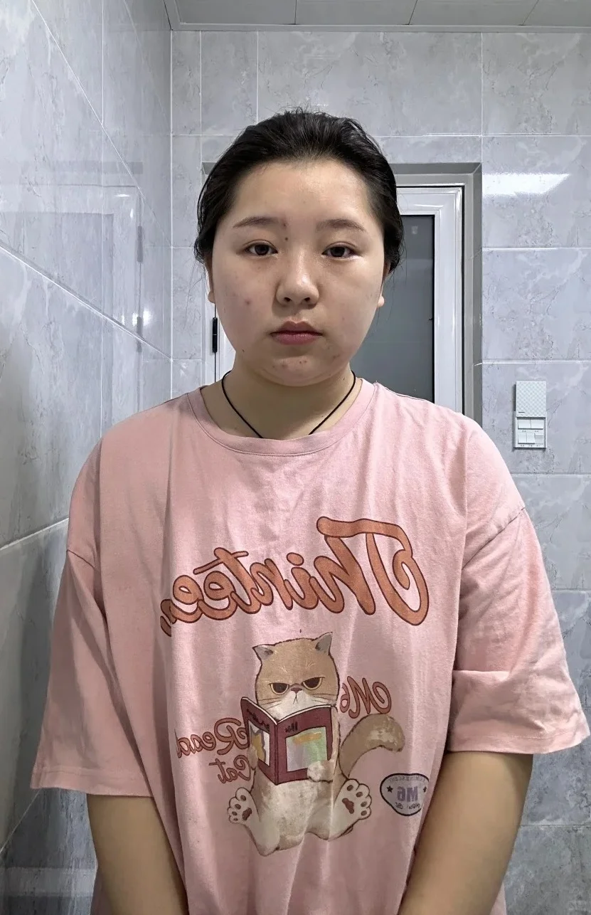 150斤胰岛素抵抗 瘦了四十斤对比图。。。