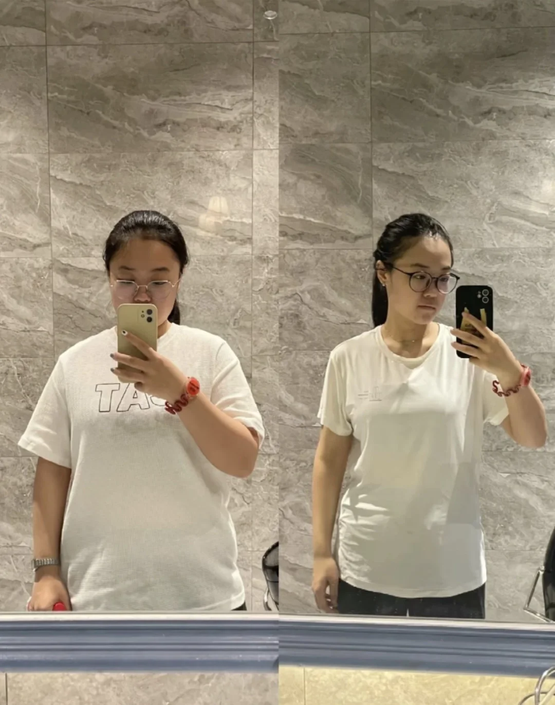 这就是胰岛素抵抗瘦了26斤的真实样子