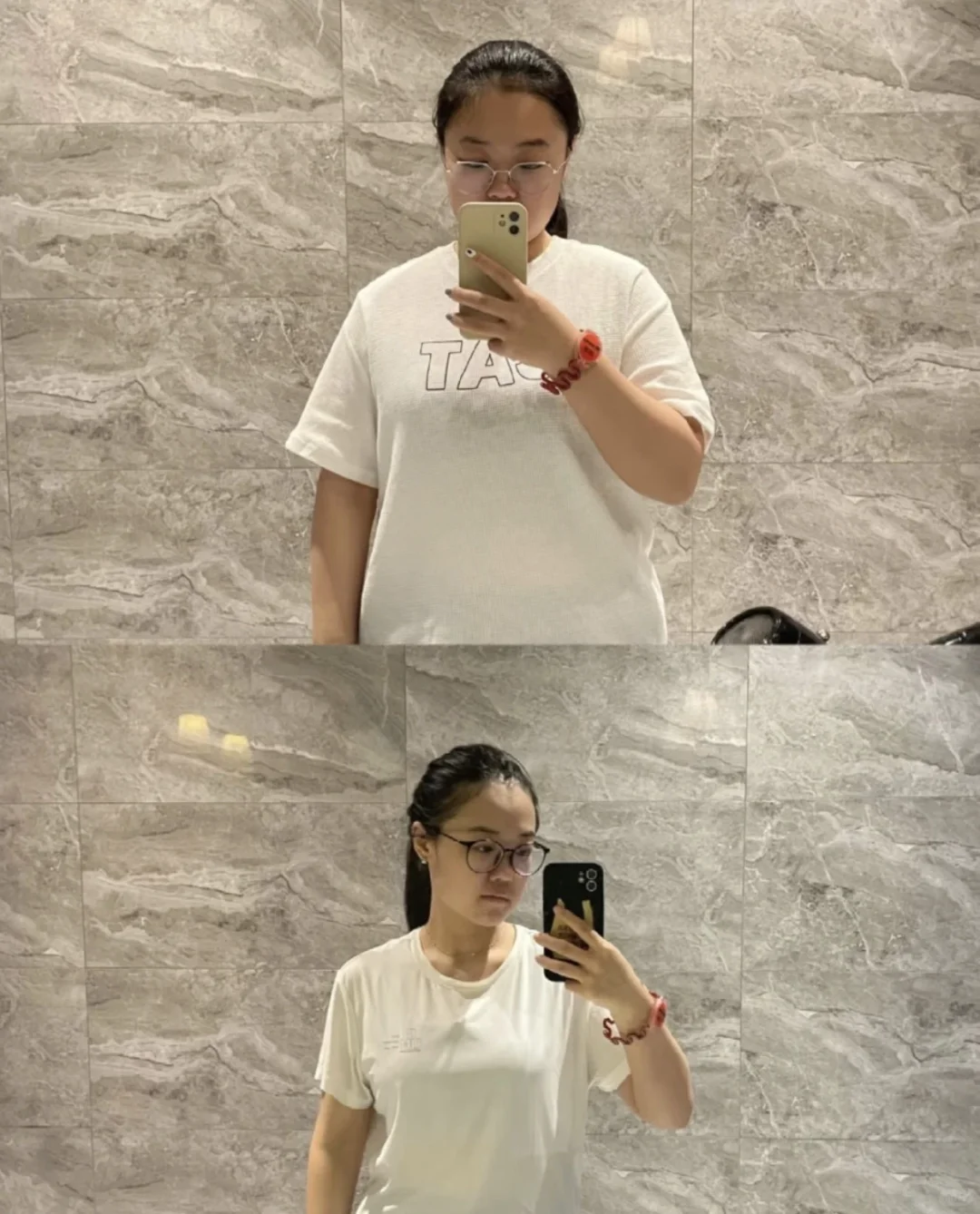 这就是胰岛素抵抗瘦了26斤的真实样子