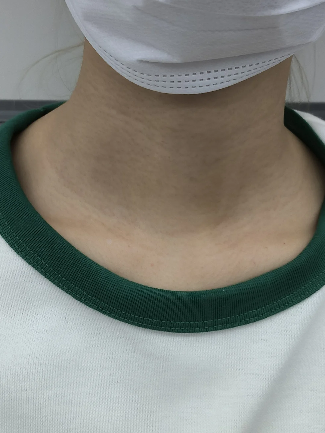 怀疑自己有糖前又去检查