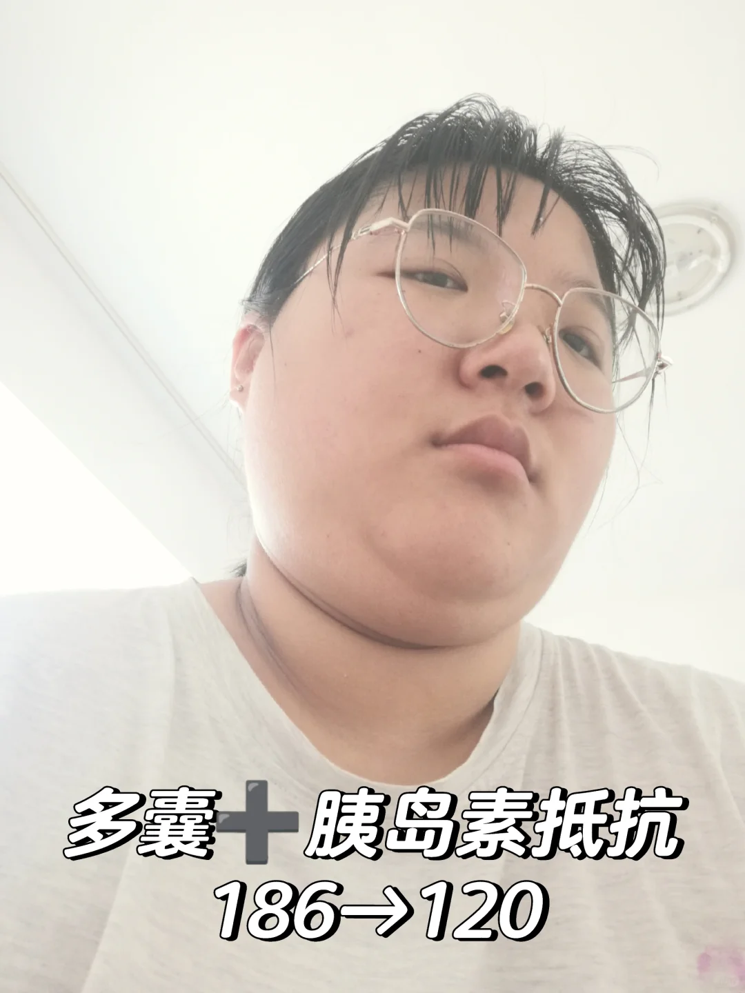 多囊+胰岛素抵抗186→120身材已达next levl