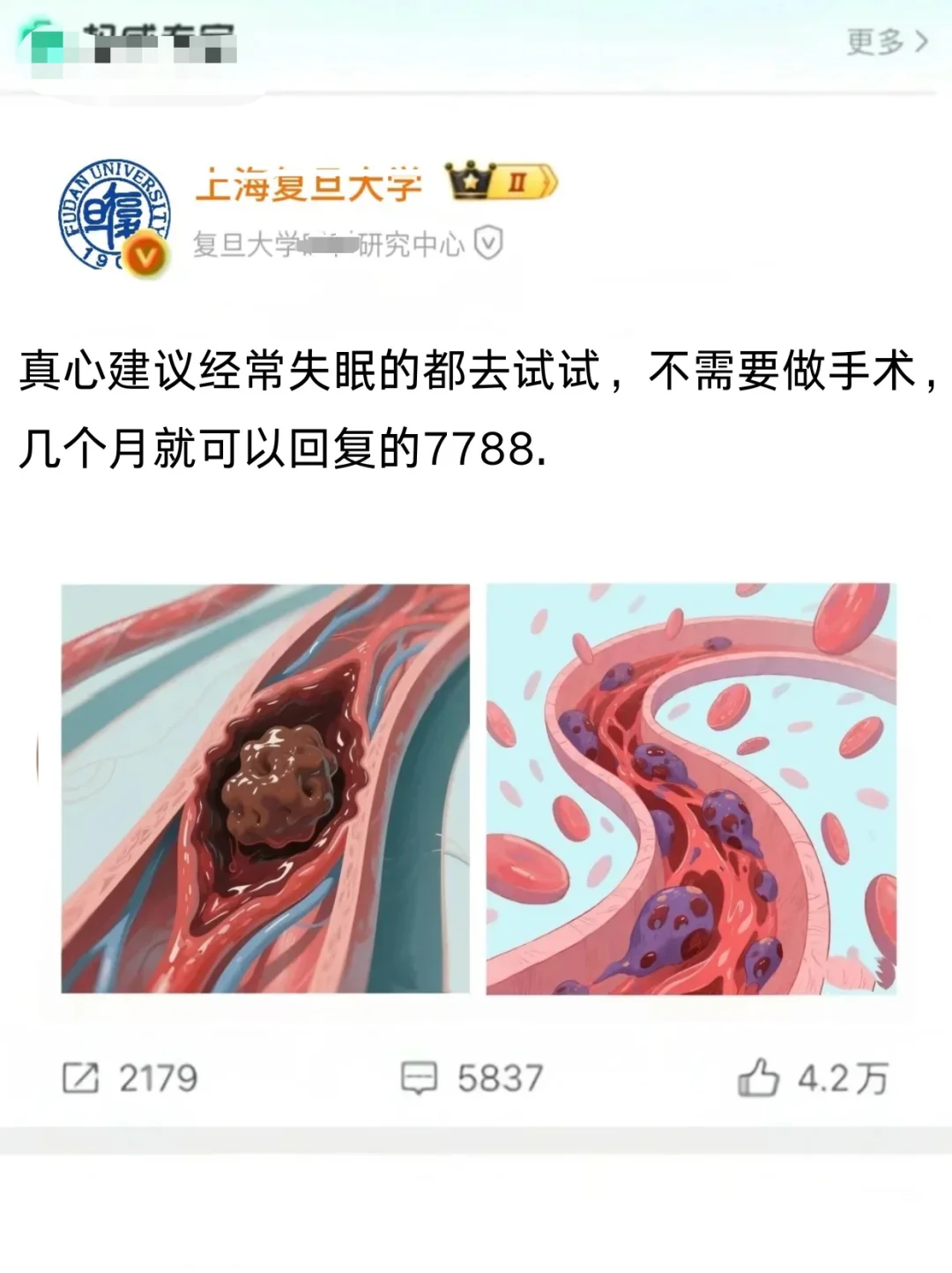 复旦大学迄今为止对抵抗失眠的蕞刁方法