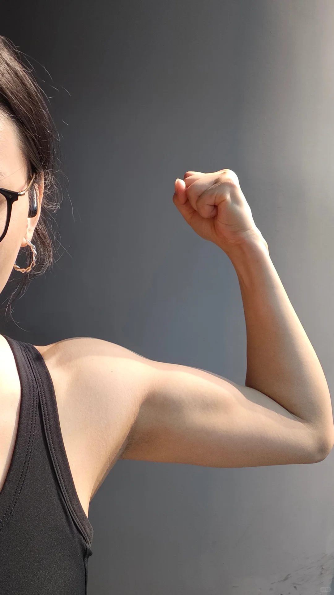 多囊+胰岛素抵抗｜瘦了40斤，我像换了个人