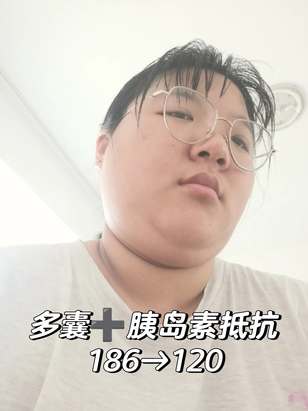 多囊+胰岛素抵抗186-120,get素颜杀伤力