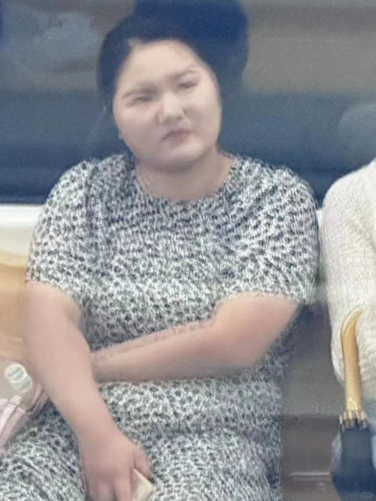 胰岛素抵抗好转后我的状态发生巨大变化!