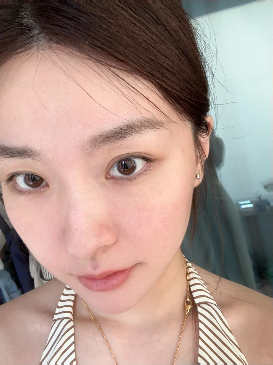 最近的皮肤状态绝了