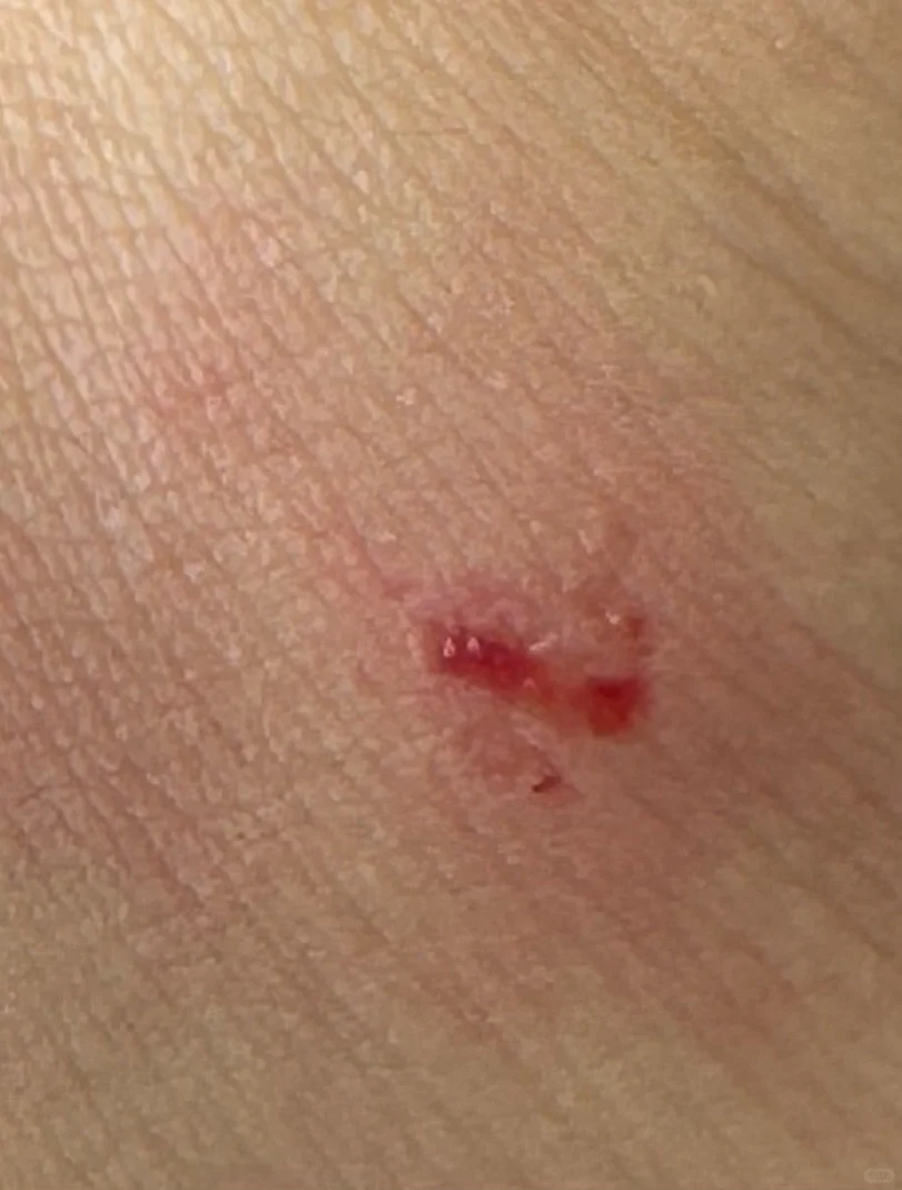 在上海的苏州河畔看展览被保安辱骂打伤！