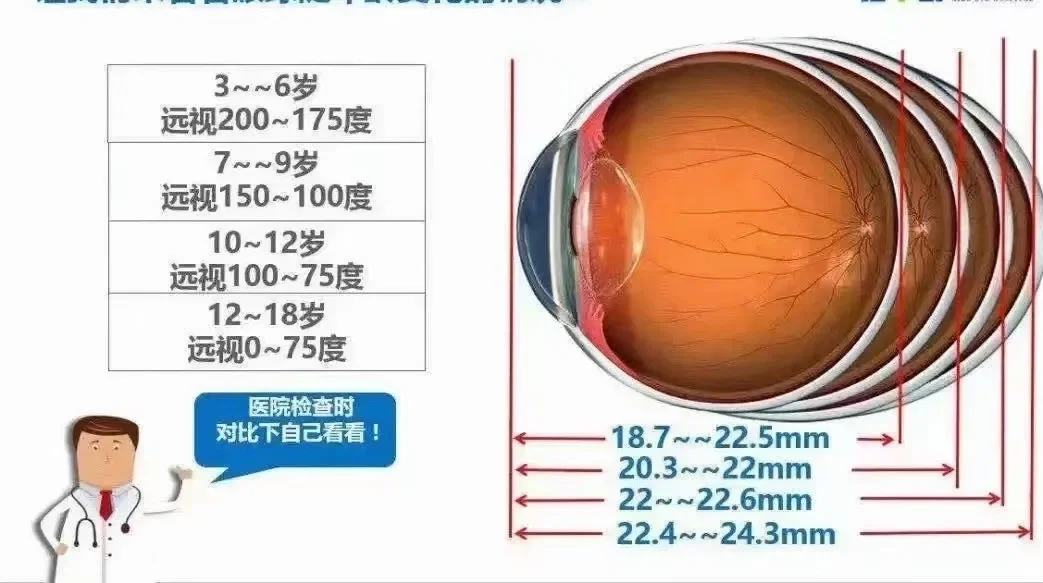 近视，度数，眼轴都懂了。