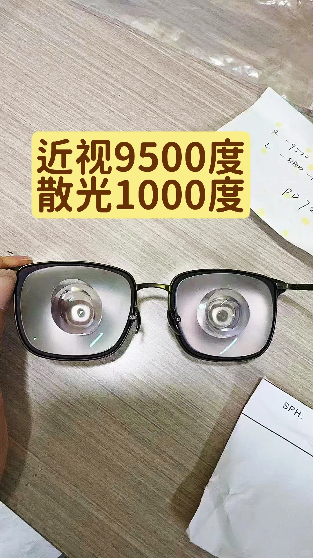 深圳近视9500度➕1000度超高散