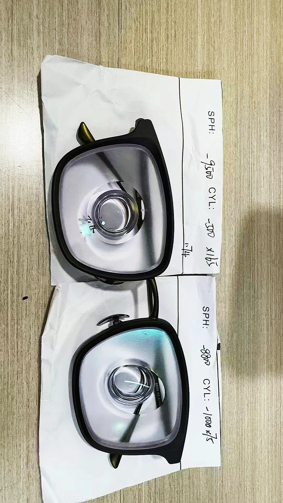 深圳近视9500度➕1000度超高散