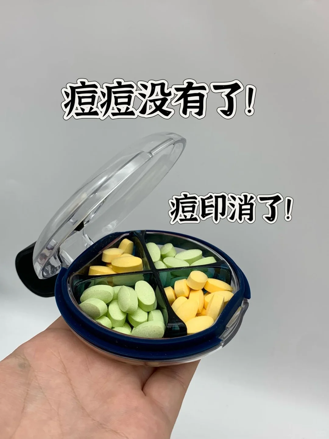 痘印没有了！早B晚C内调！