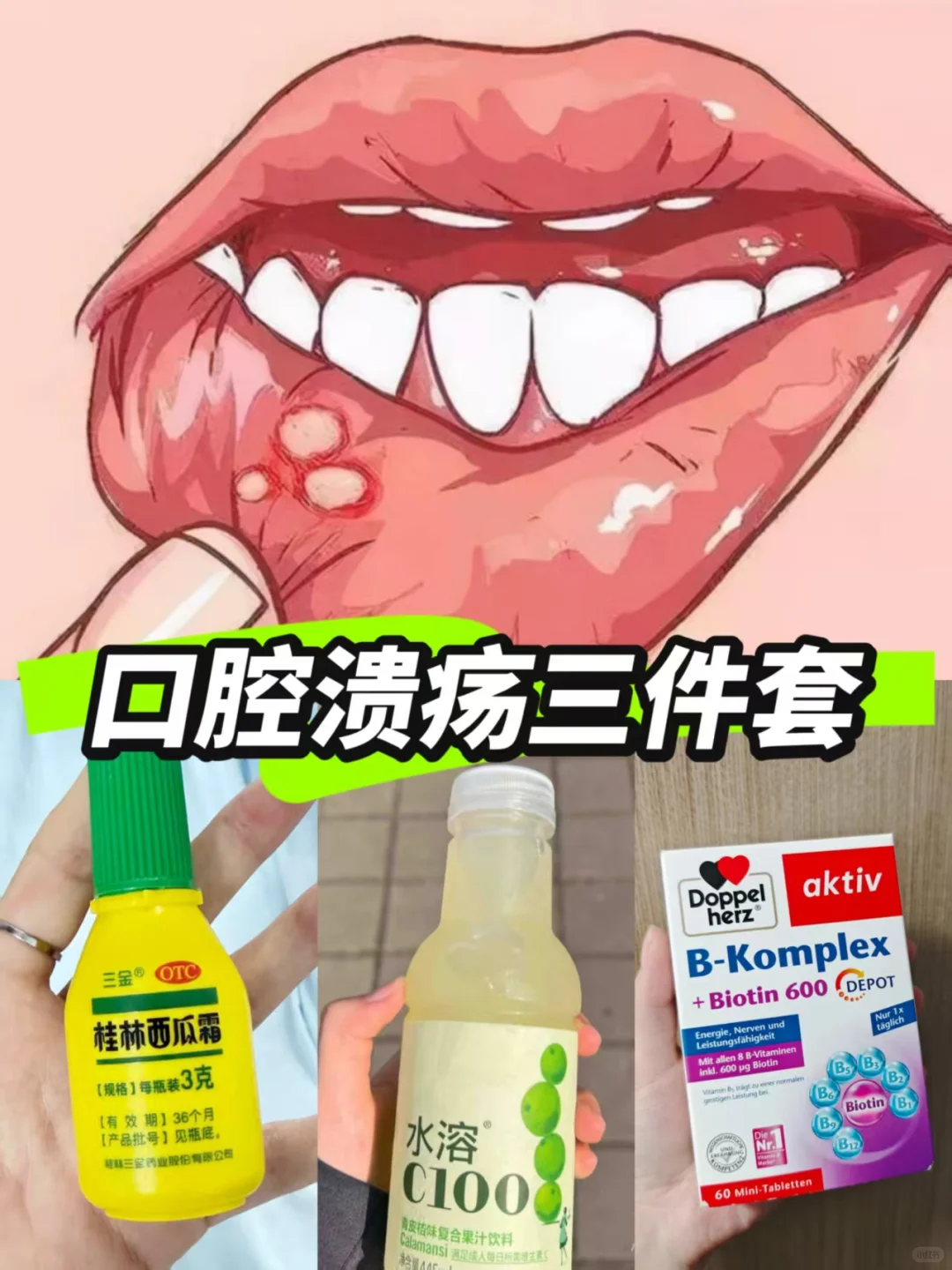 口腔溃疡三件套！