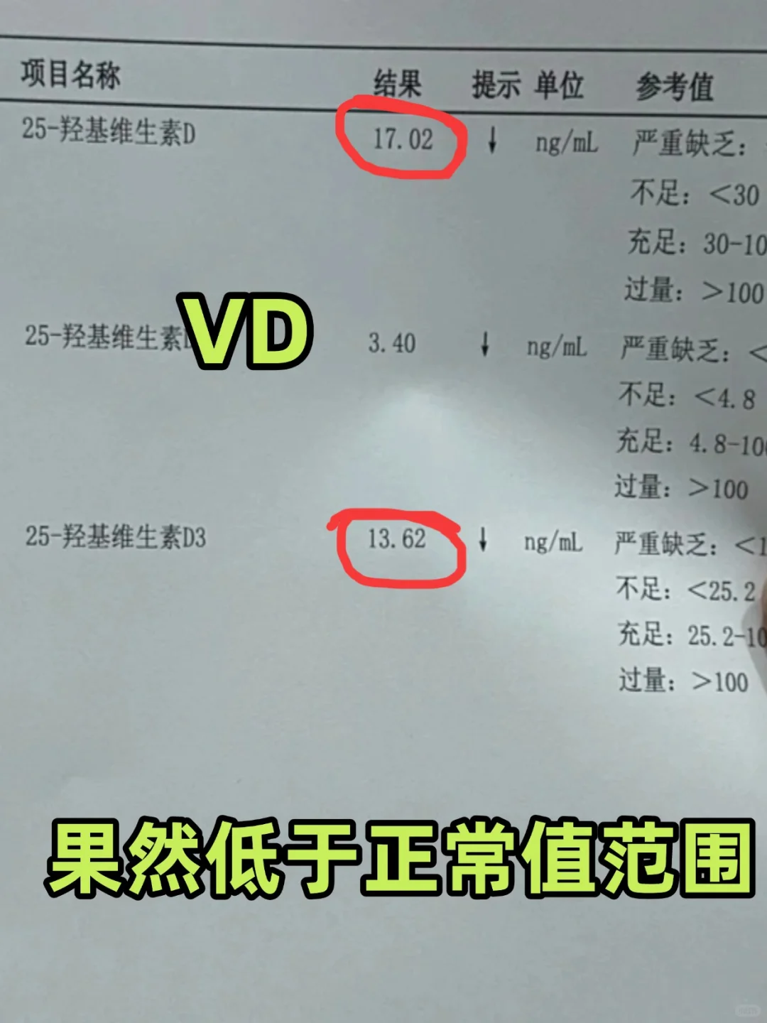 已确诊：缺乏维生素D（附检测流程）