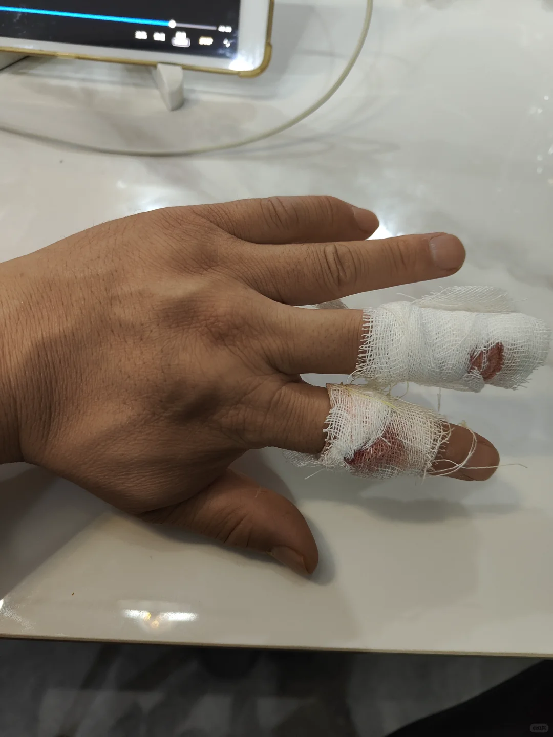 角磨机的风险系数，我中招了，时刻注意吧！