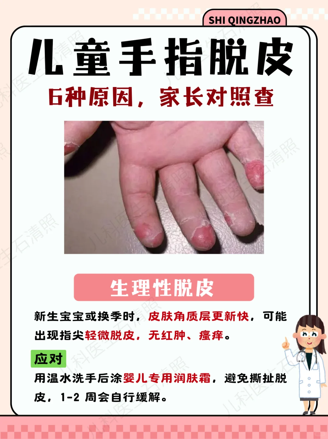 娃手指脱皮是缺维生素吗？6种原因都有可能