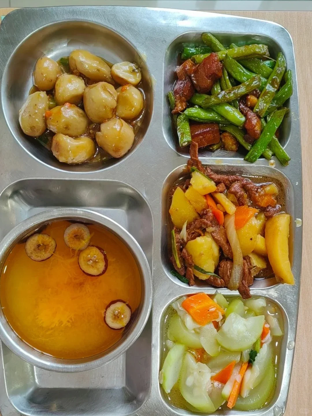 医疗电子厂月薪7000，一年又一年！！