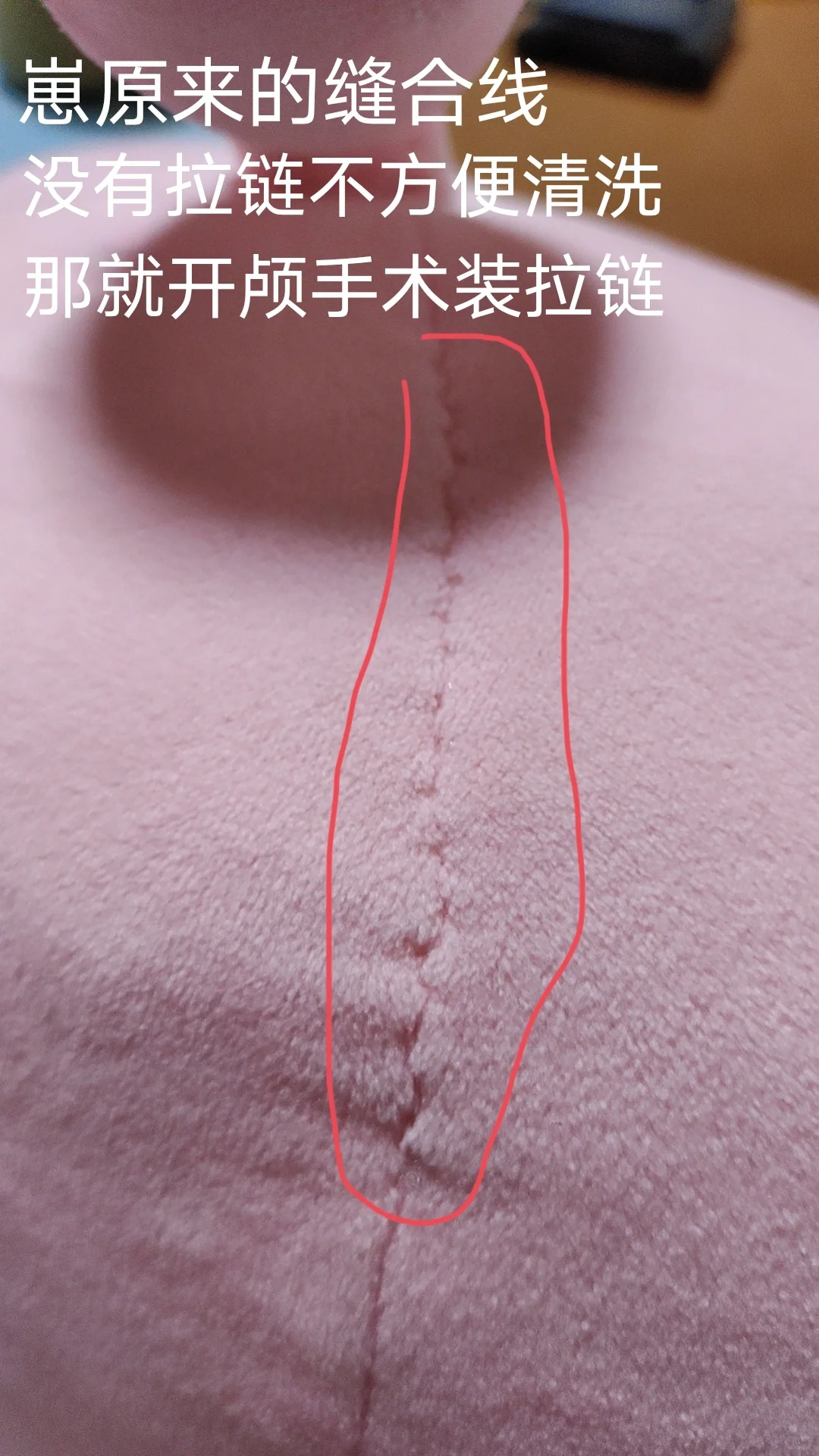 今天做“开颅手术”！