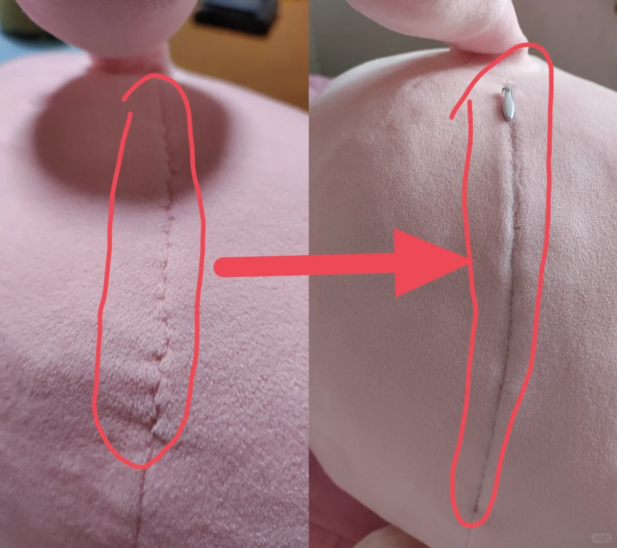 今天做“开颅手术”！