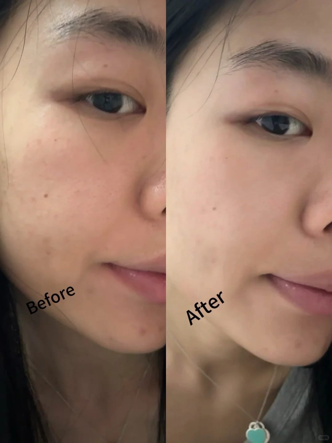 28天护肤打卡|胶原蛋白真的回来了!