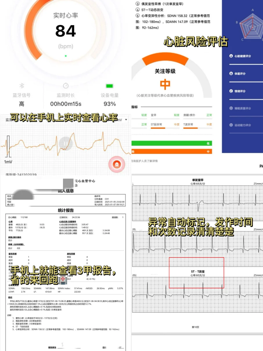 动态心电仪...有小伙伴用过吗？