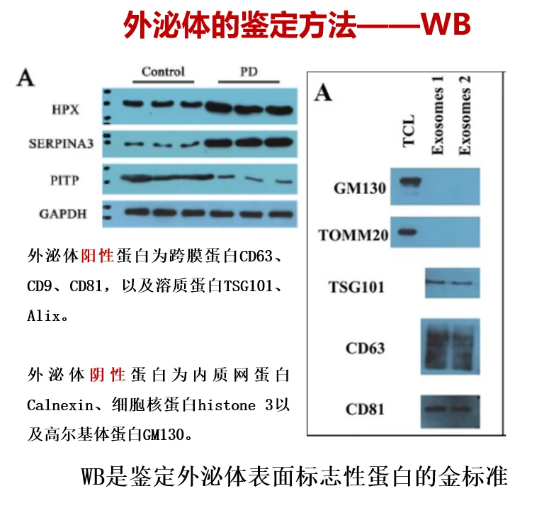 一文搞定外泌体鉴定方法??