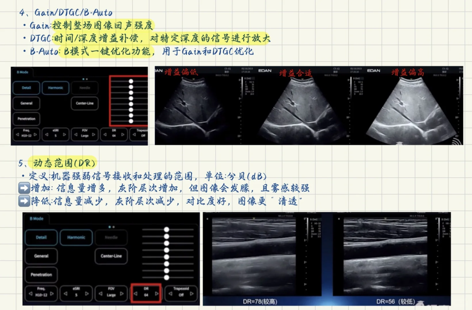 终于学会了超声仪器调节！！！