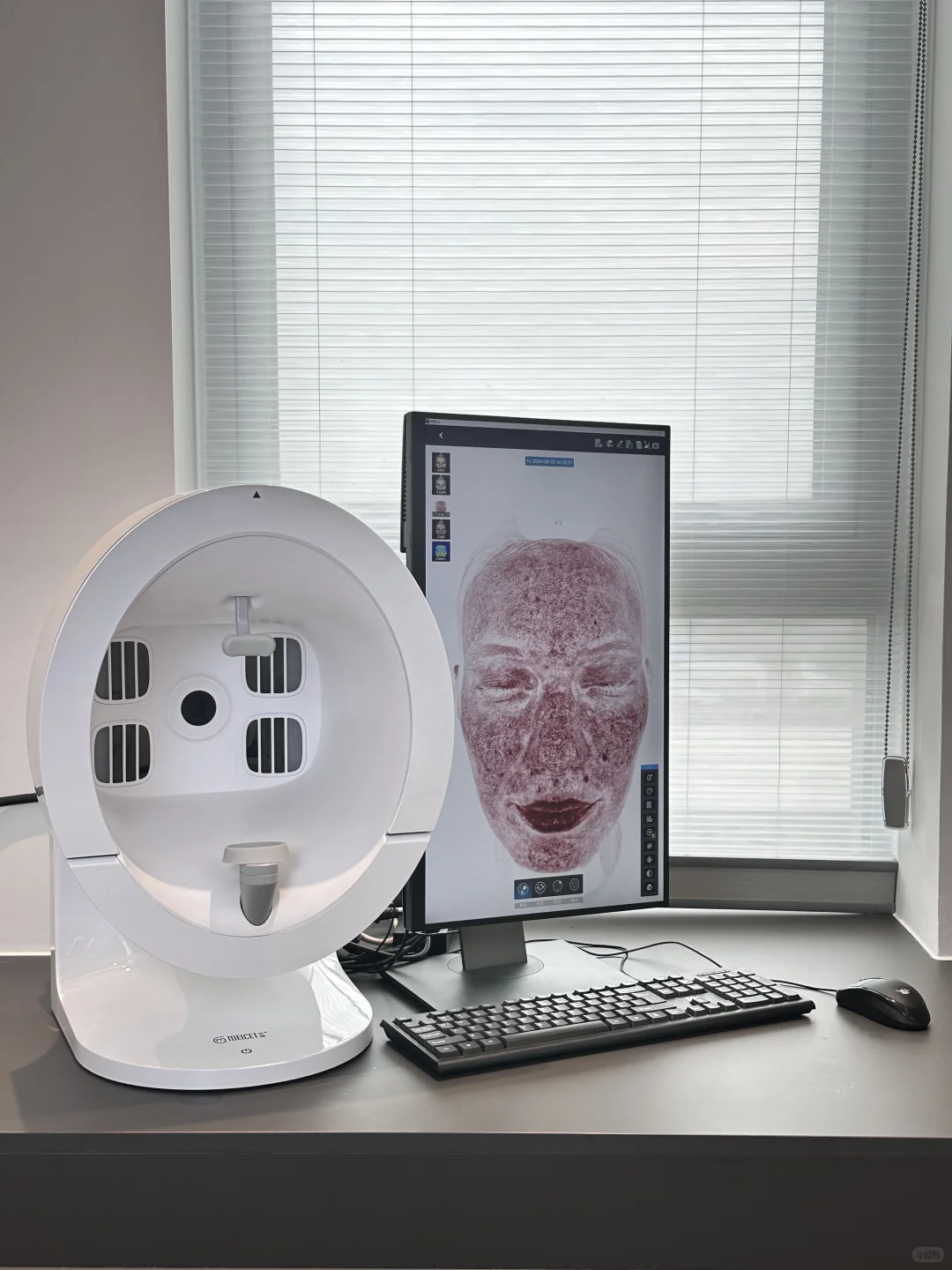 狠狠心还是换了美测prob的珠光白?