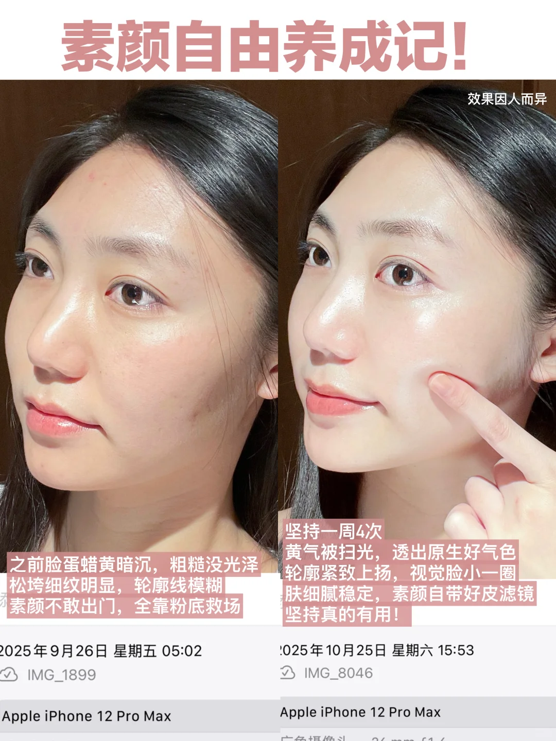 这美容仪强到逆天！把松弛垮脸盘活了！