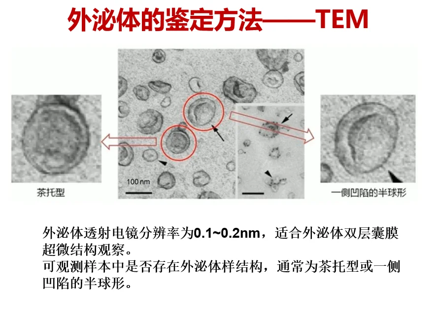 一文搞定外泌体鉴定方法??