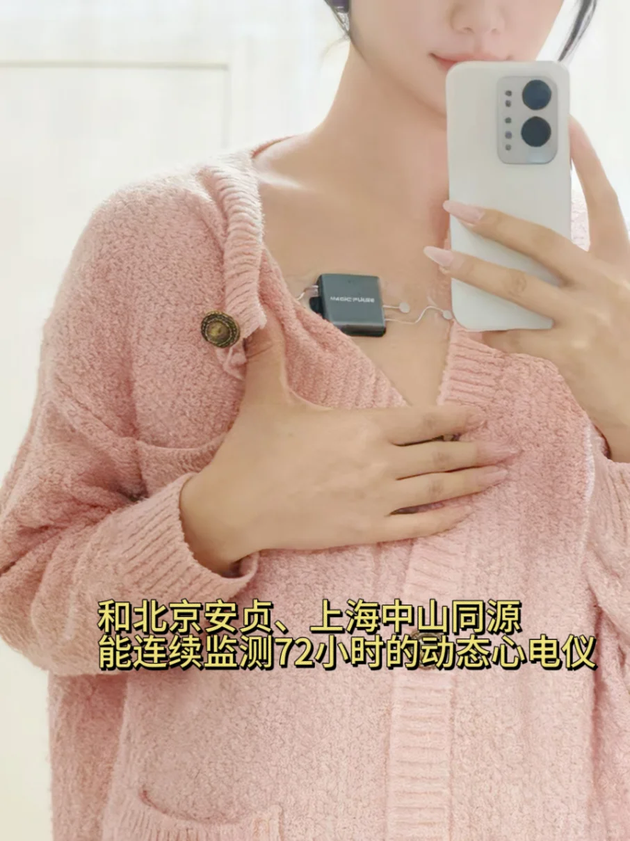动态心电仪...有小伙伴用过吗？