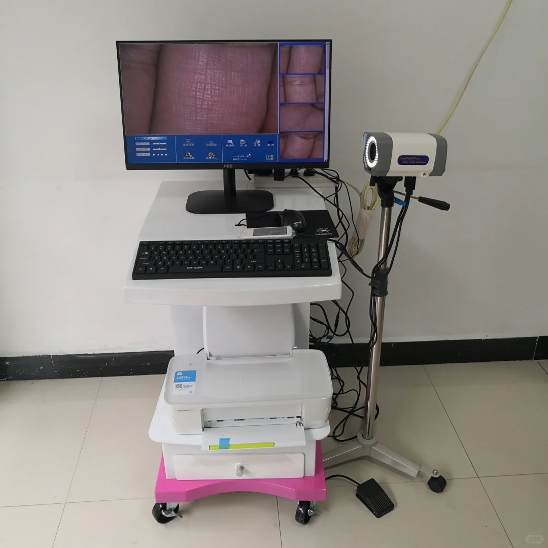 高清数码电子阴道镜