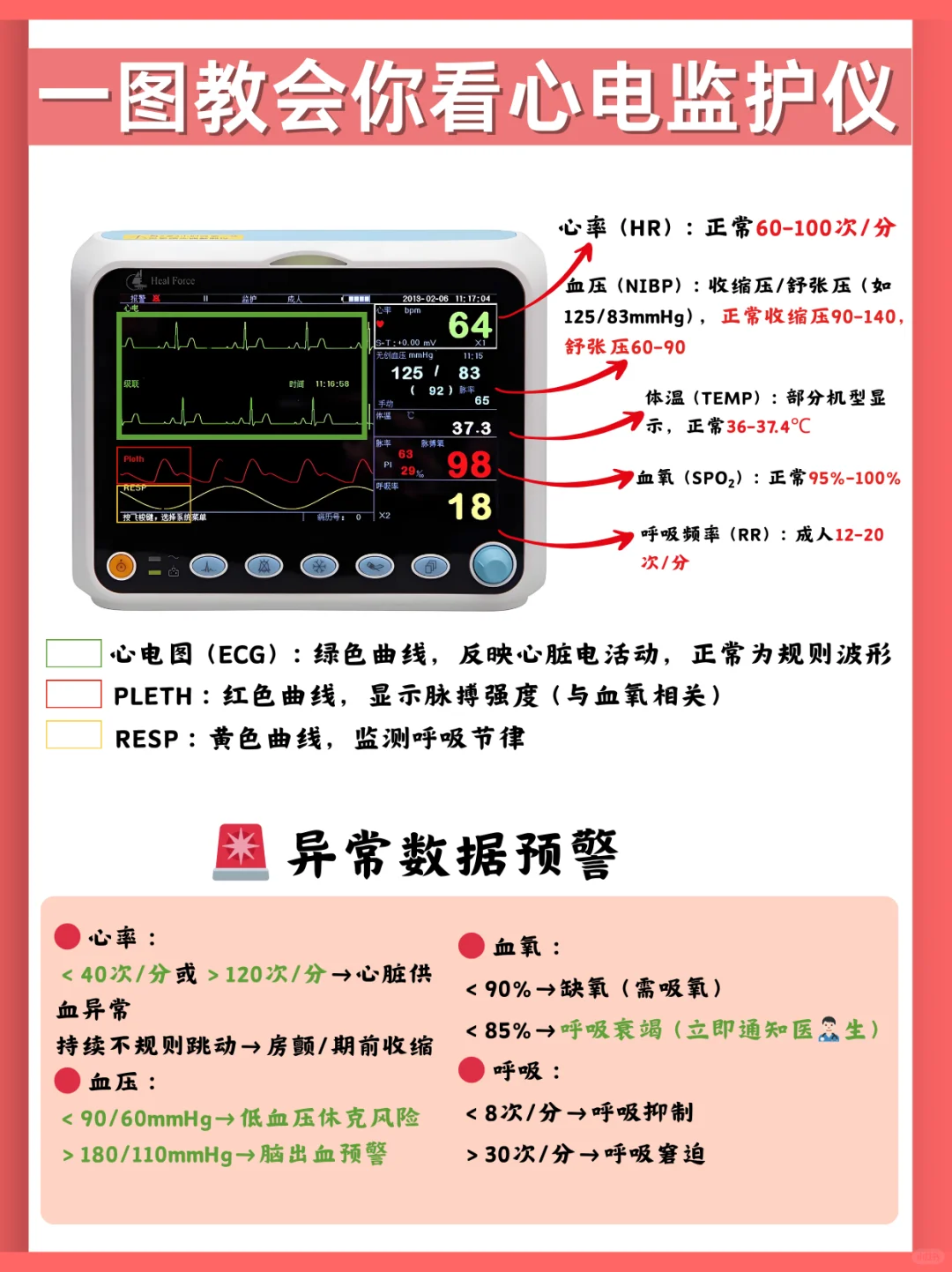 家属必看!一文教你读懂监护仪⚠️