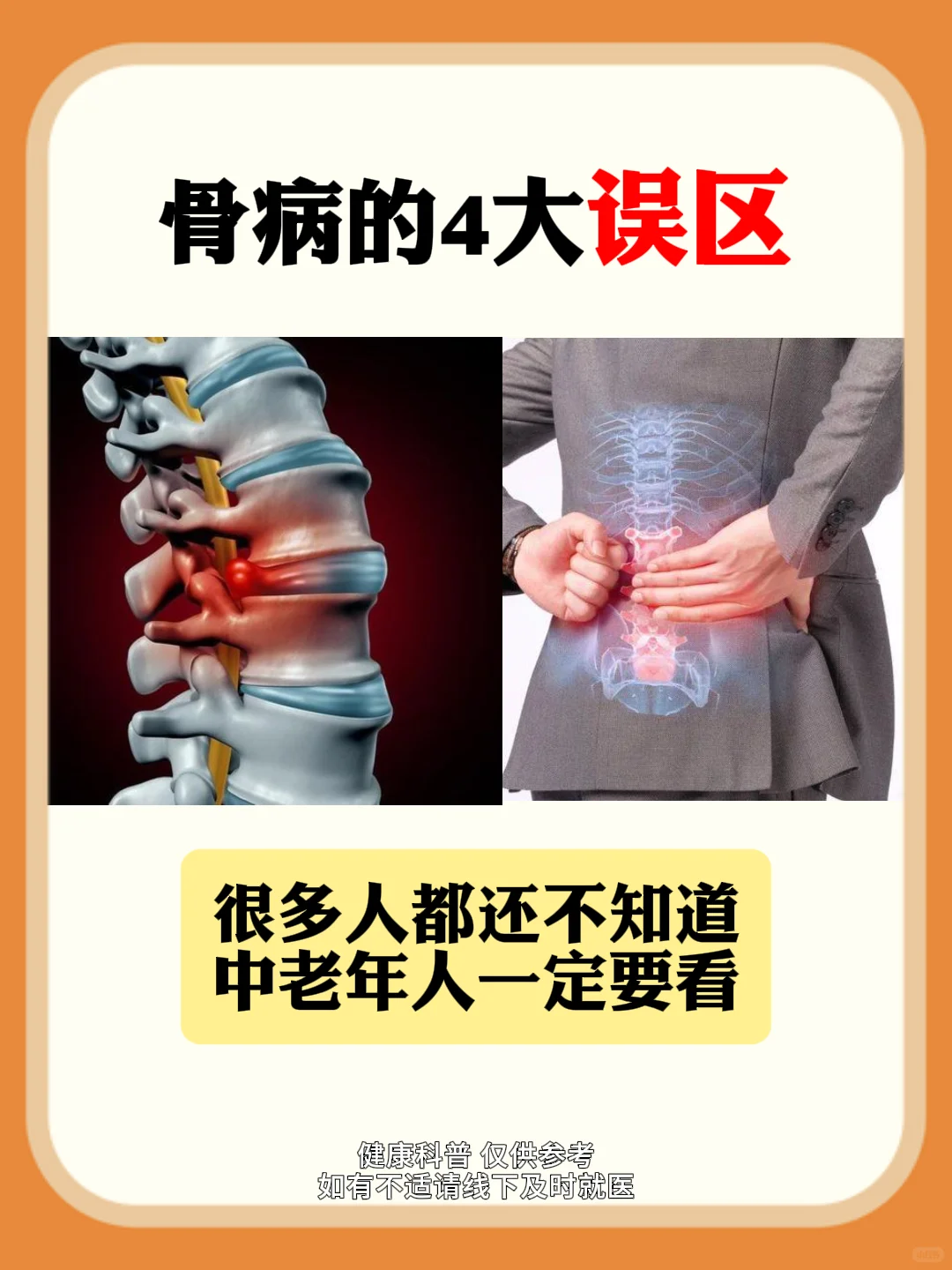 骨病的四大误区，你知道几个？