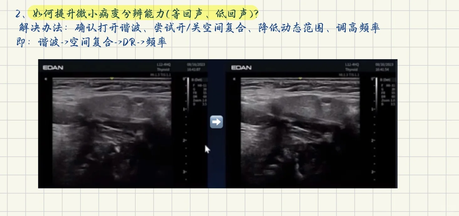 终于学会了超声仪器调节！！！