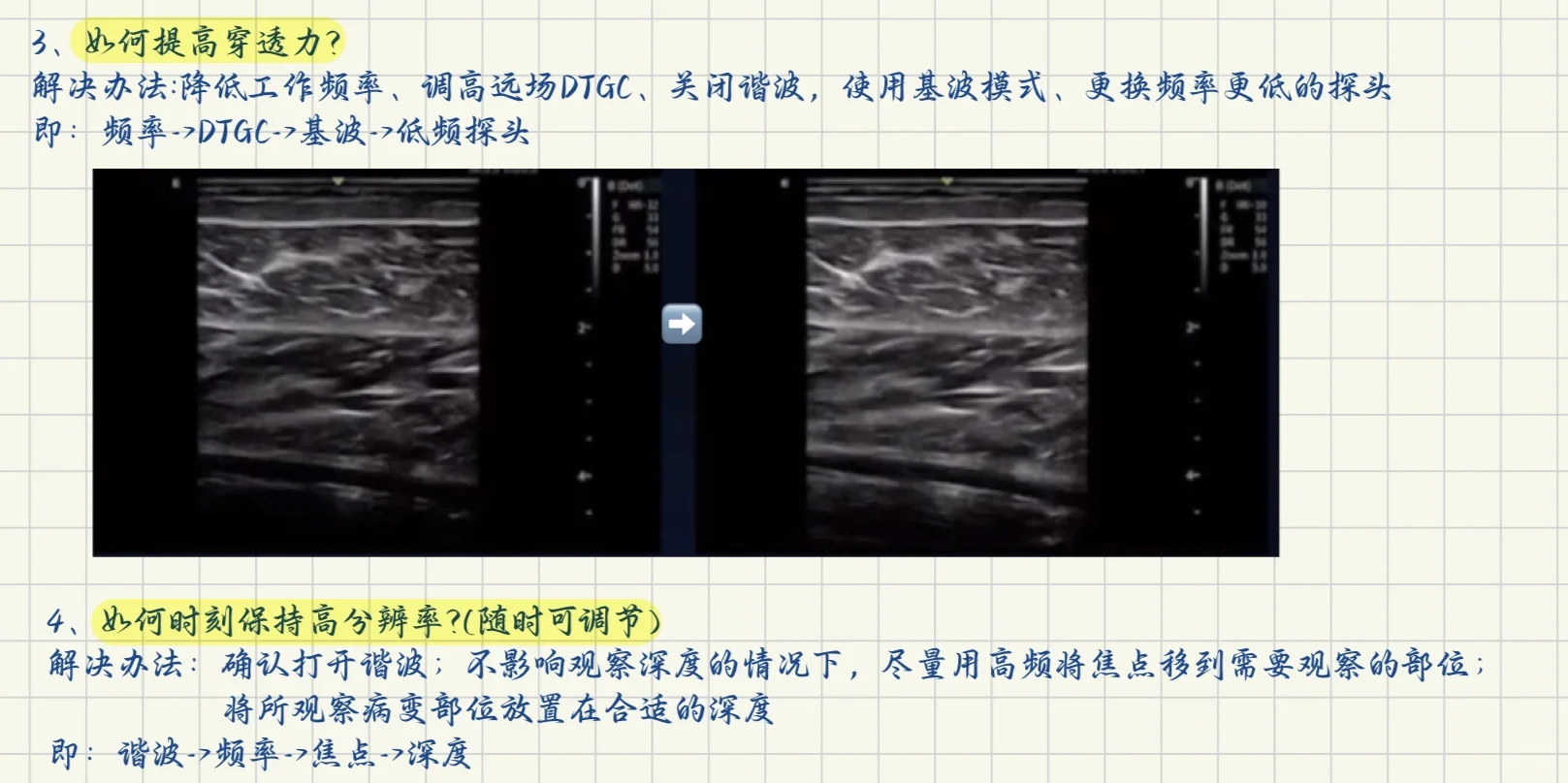 终于学会了超声仪器调节！！！