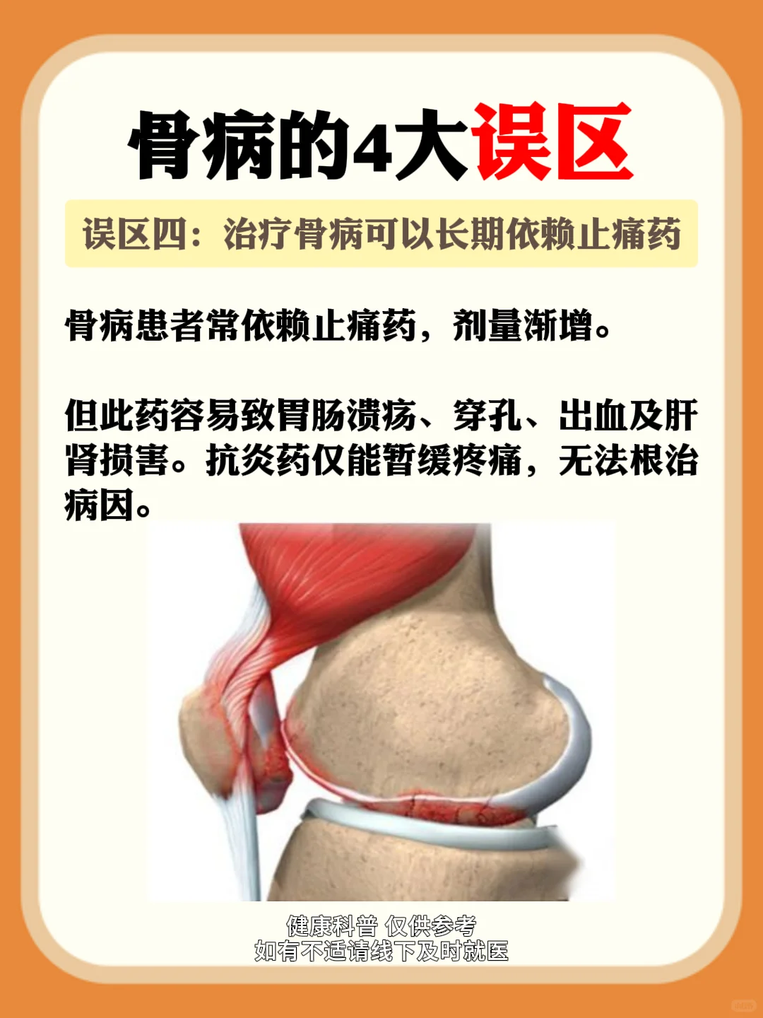 骨病的四大误区，你知道几个？