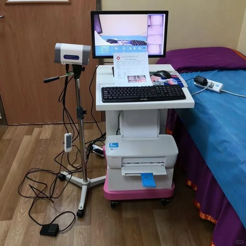 高清数码电子阴道镜