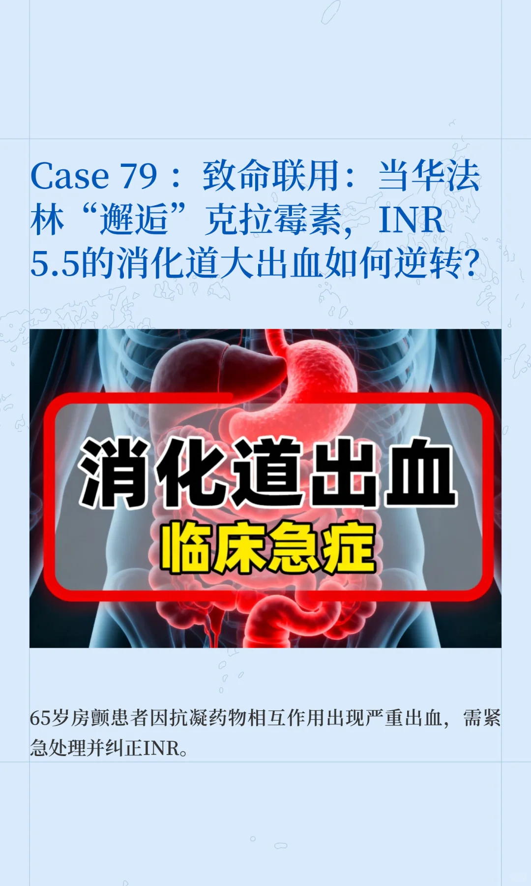 致命邂逅！华法林遇上这个药，竟大出血休克