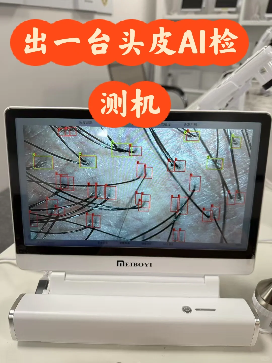 出一台AI智能头皮检测仪