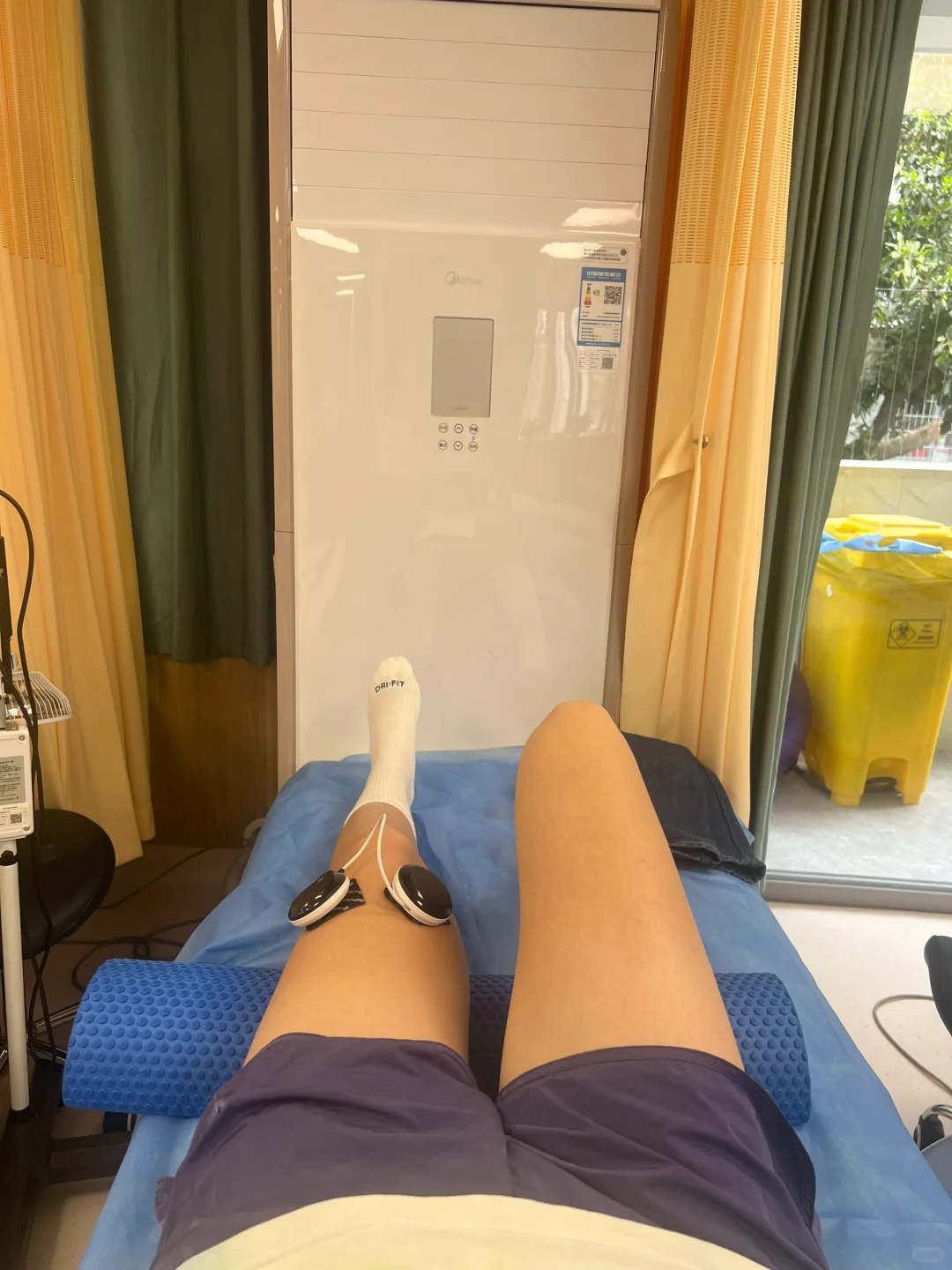 半月板撕裂｜针灸+电疗+激活+松解