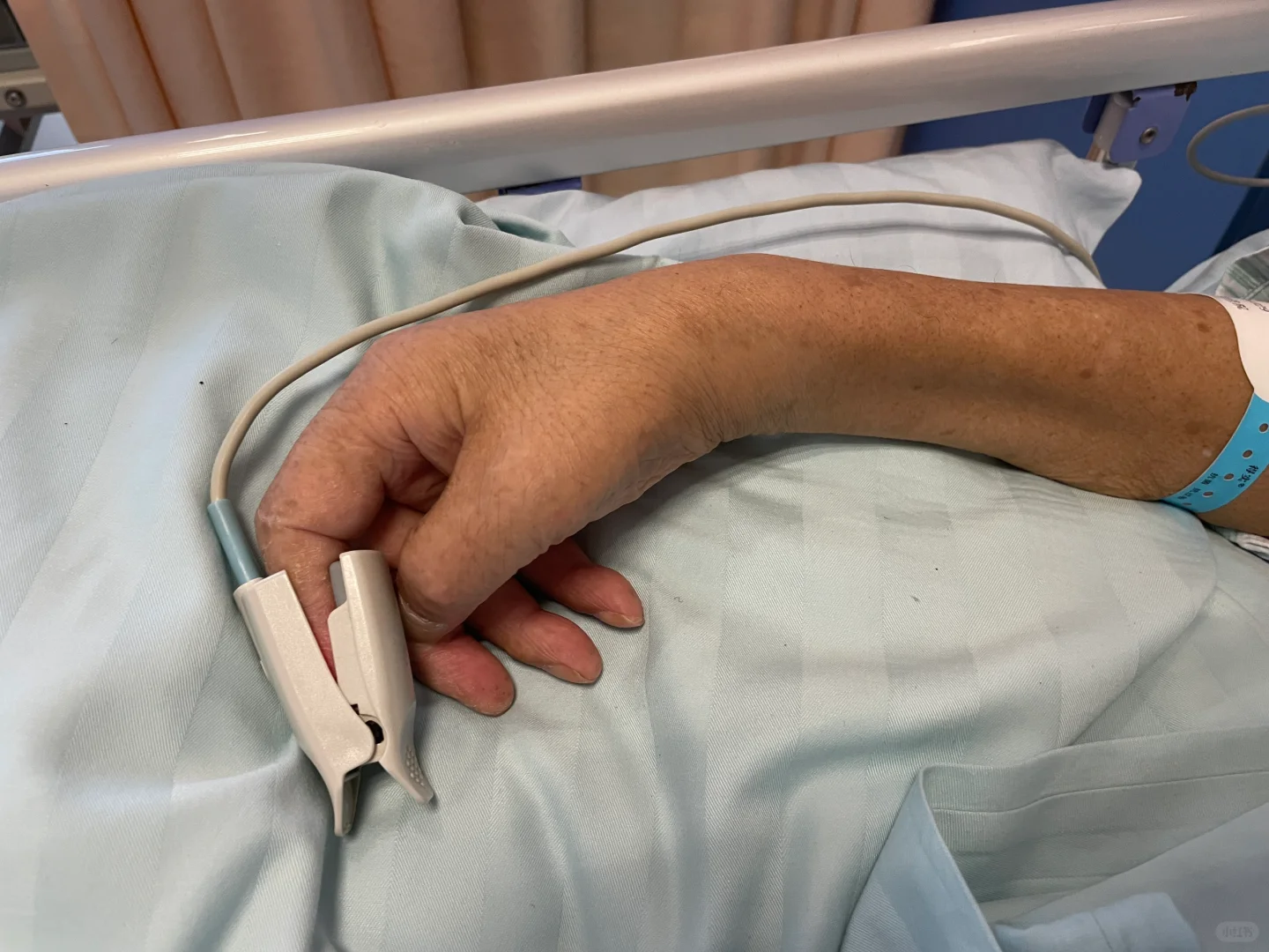 脑梗6｜机器人手助恢复锻炼肌肉