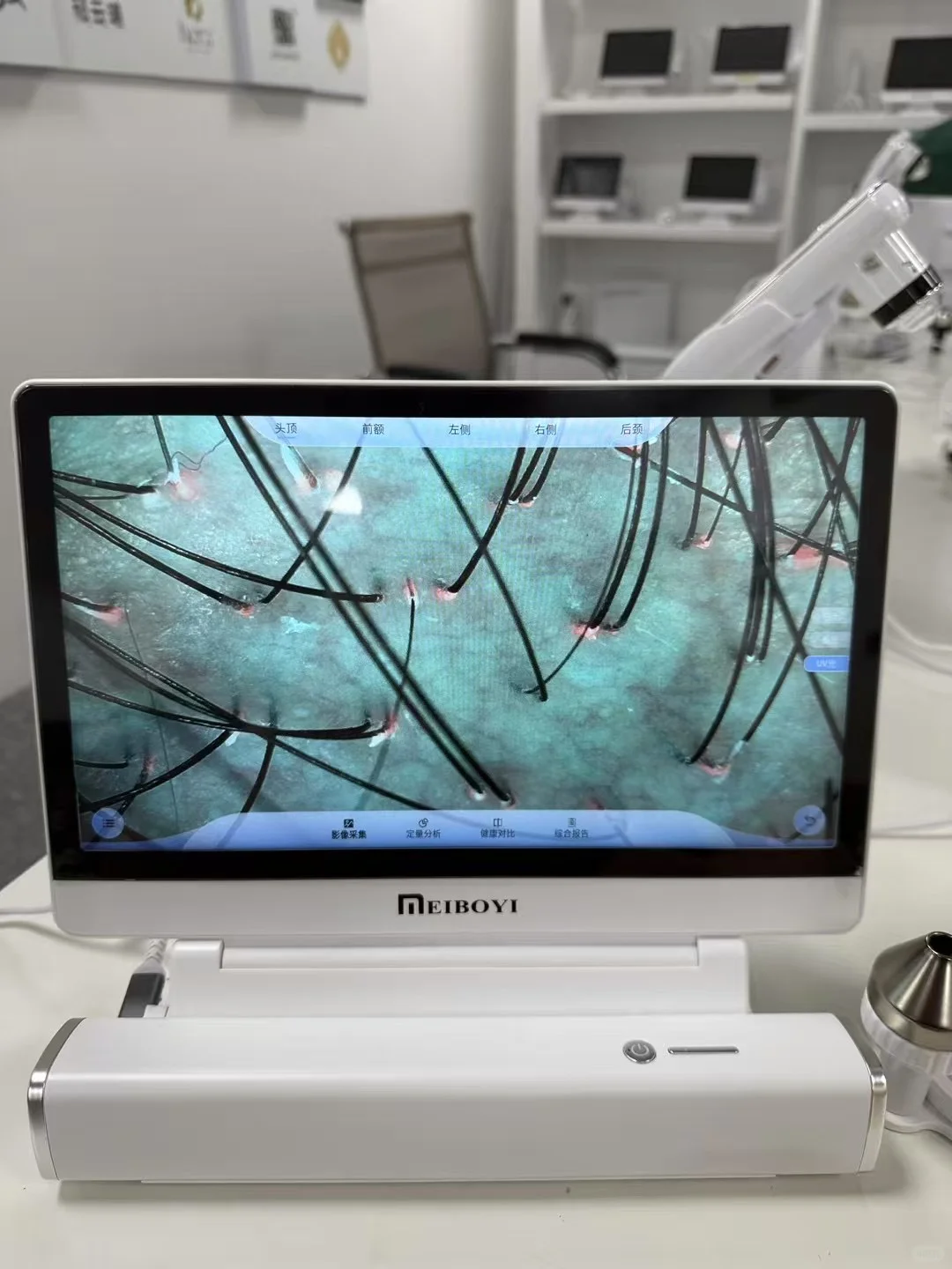 出一台AI智能头皮检测仪