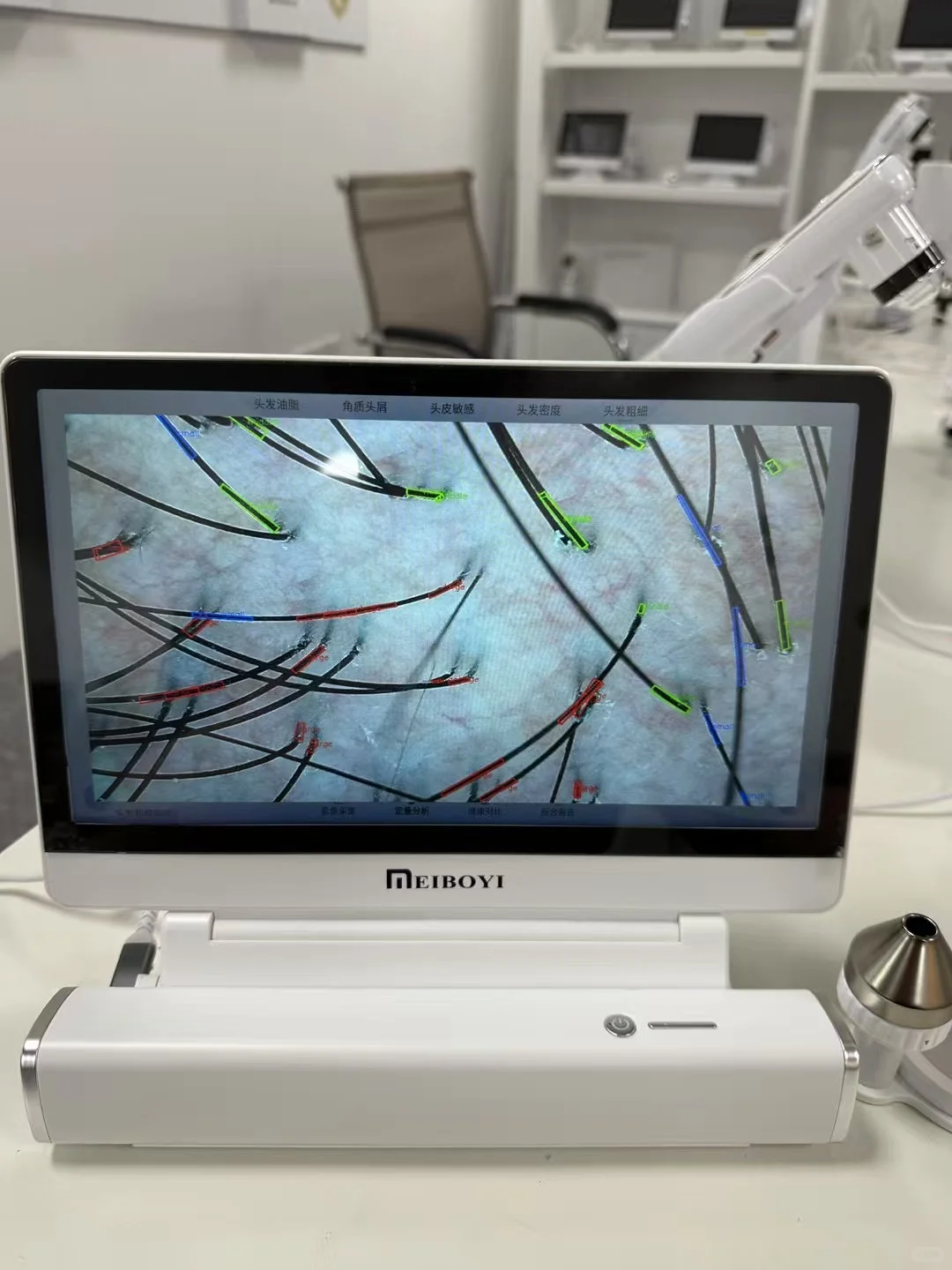 出一台AI智能头皮检测仪