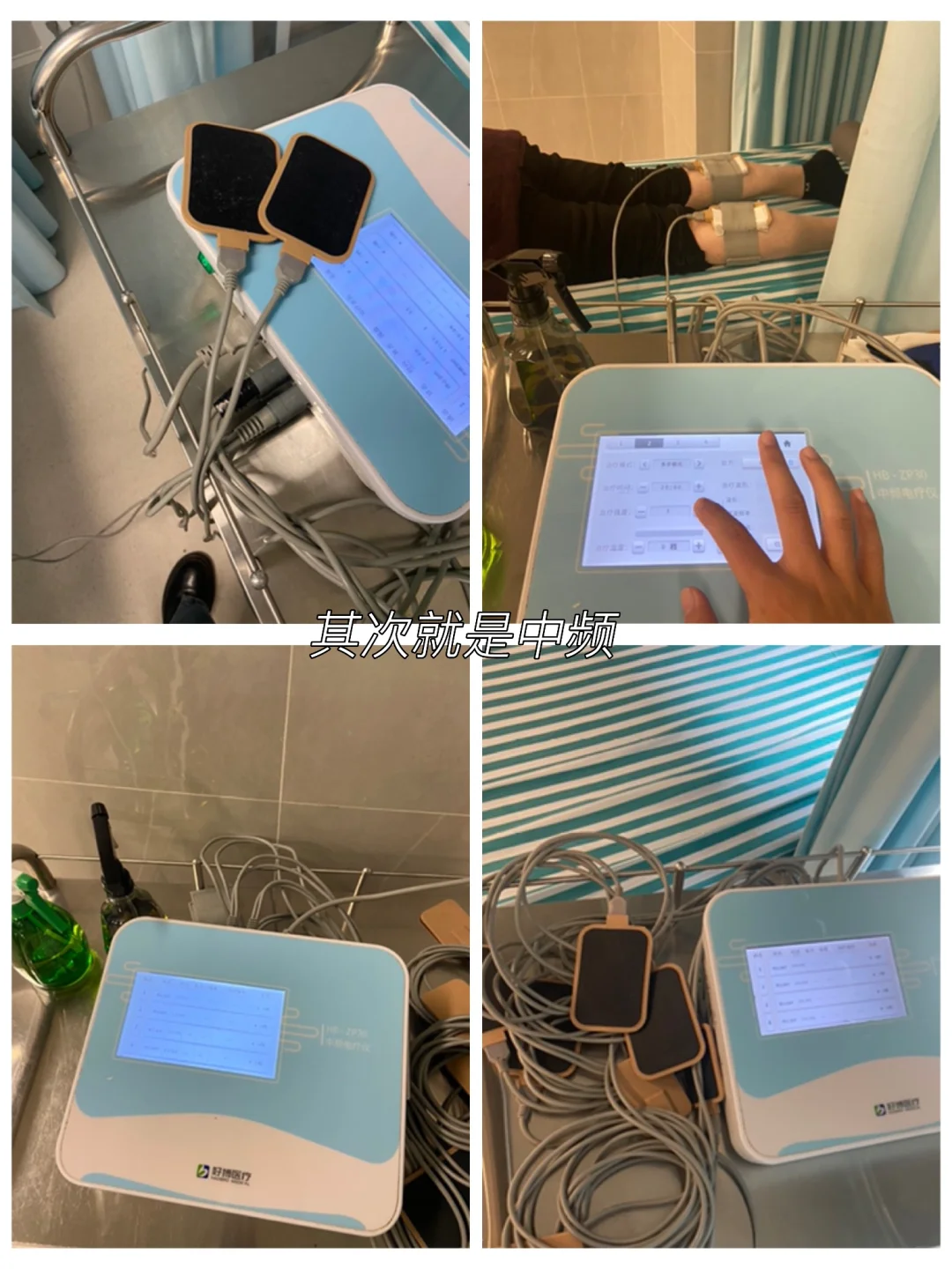 在康复医学科理疗室上班一天都干些什么呢