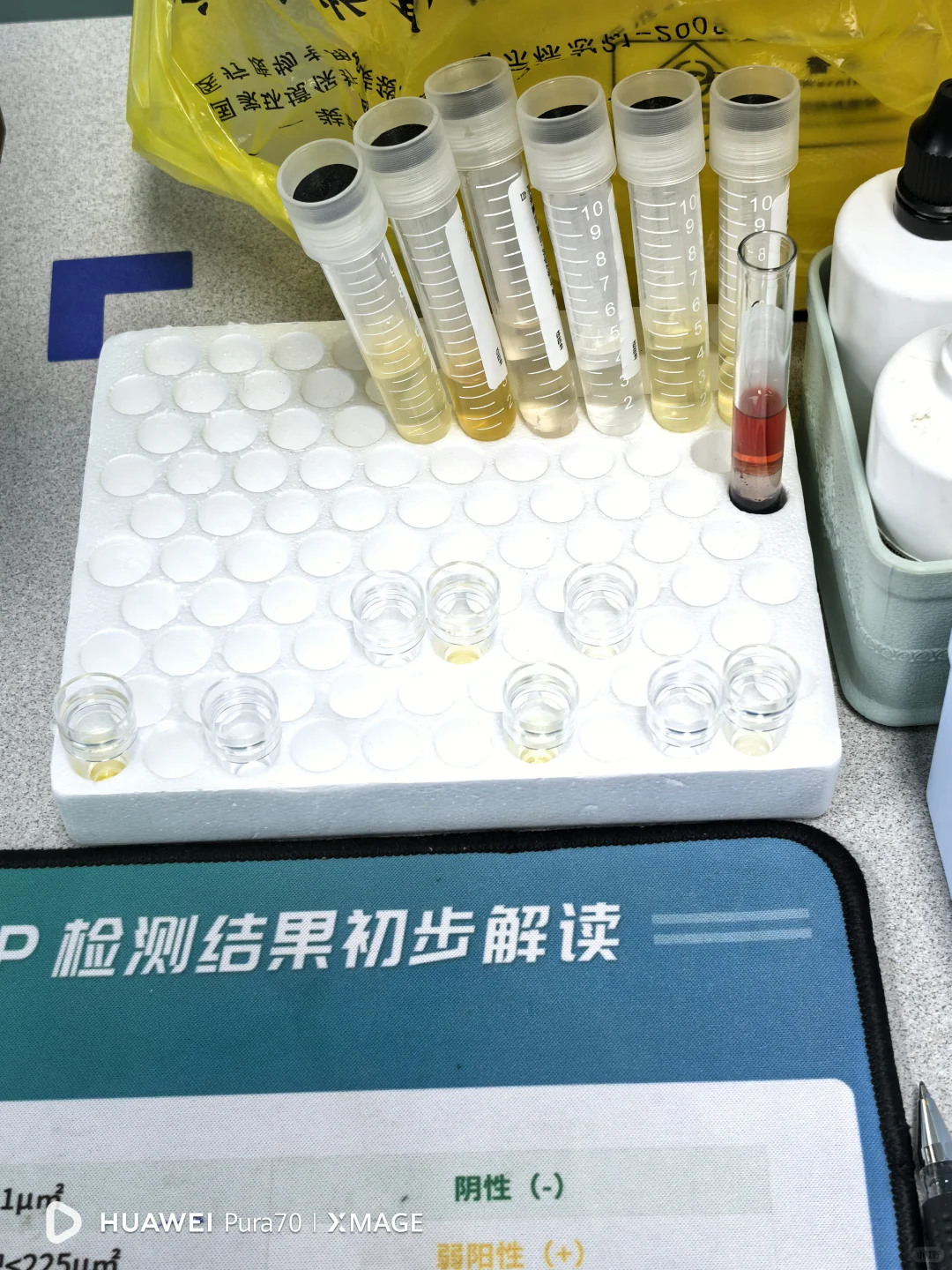 4.17 生化单机+血气分析