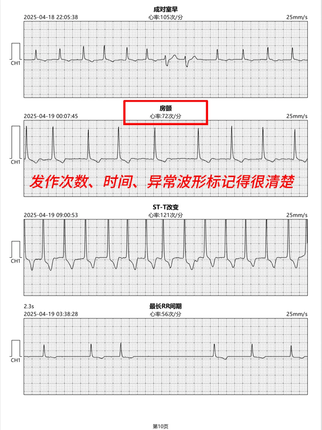 MagicPulse动态心电记录仪非常好用
