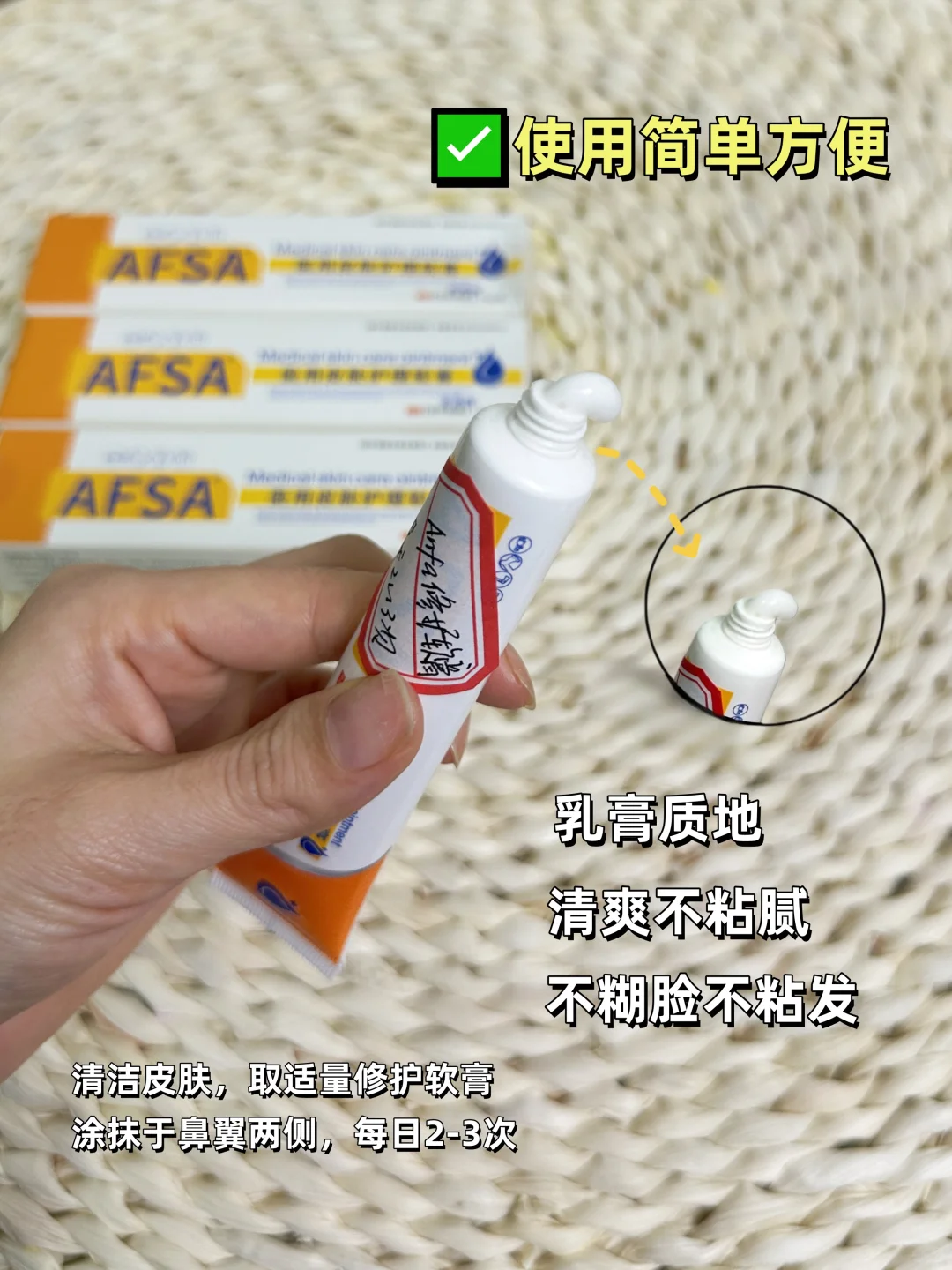 鼻翼两侧脂溢性皮炎人群看过来!