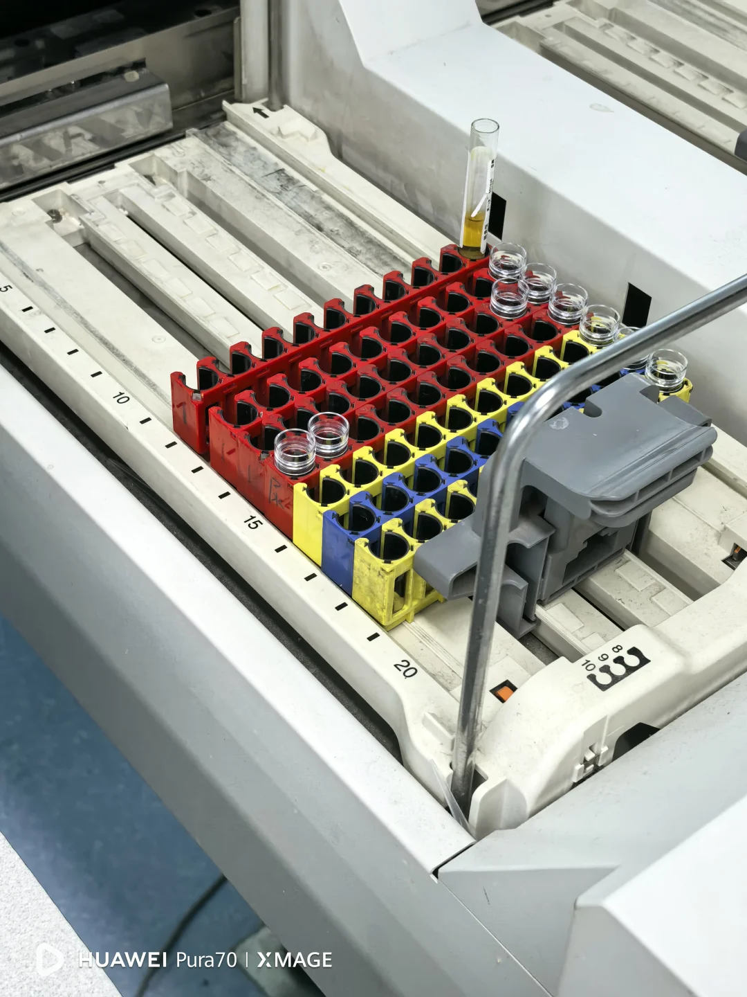 4.17 生化单机+血气分析